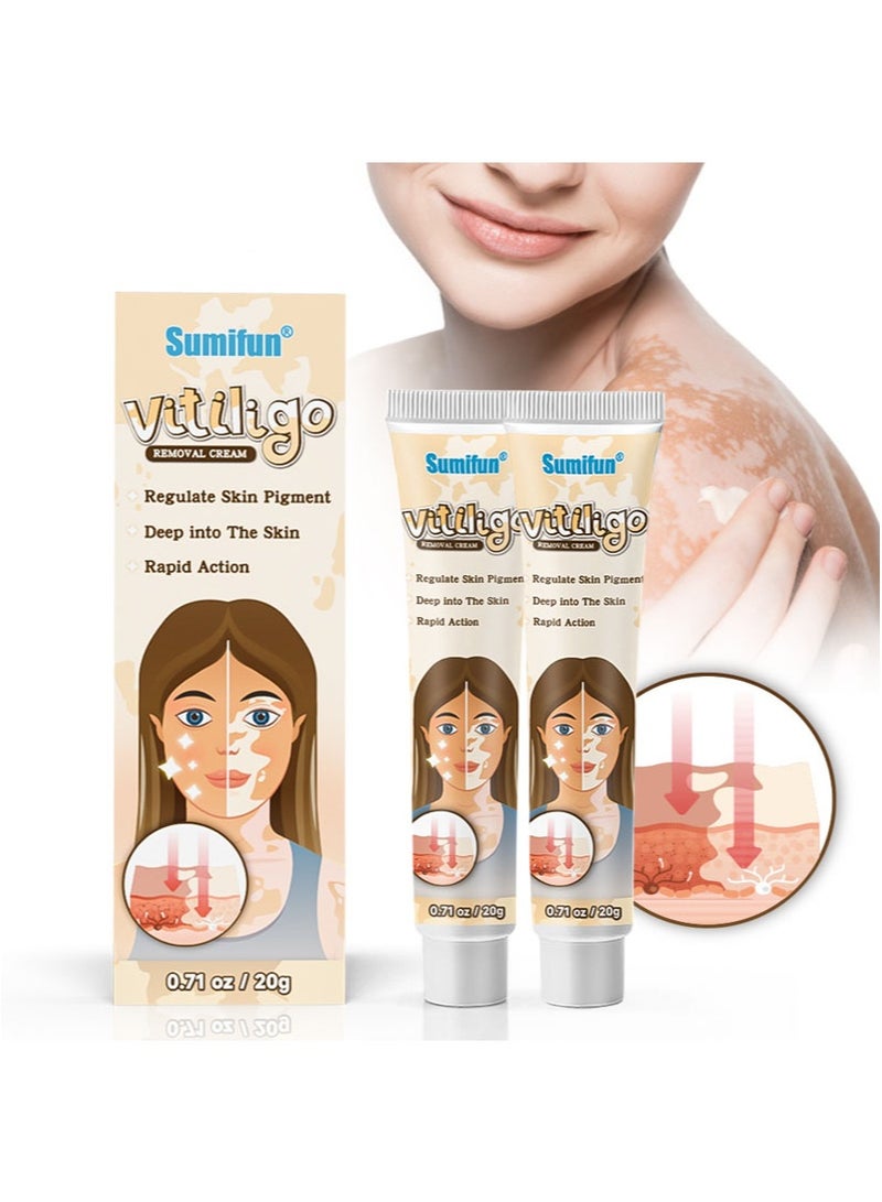 سوميفون كريم لإزالة البهاق 2 قطعة يحسن تصبغ الجلد ويقلل البقع البيضاء، تركيبة طبيعية، مناسب لجميع أنواع البشرة (20 جم + 20 جم) - Image 1